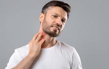 5 Penyebab Herpes di Leher, Begini Cara Mengatasinya