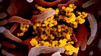 Gambar menggunakan mikroskop elektron yang tak bertanggal pada Februari 2020 menunjukkan virus corona SARS-CoV-2 (kuning) muncul dari permukaan sel (merah muda) yang dikultur di laboratorium.  Sampel virus dan sel diambil dari seorang pasien yang terinfeksi COVID-19. (NIAID-RML via AP)