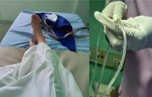 Viral Ibu di Pemalang Kena Tumor Otak Usai Suntik KB Jangka Panjang, Ini Penjelasan Dinkes Jateng