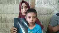 Ibu Aris, bocah penderita bocor jantung memperlihatkan hasil rontgen mengenai penyakit anaknya. (Liputan6.com/Rino Abonita)