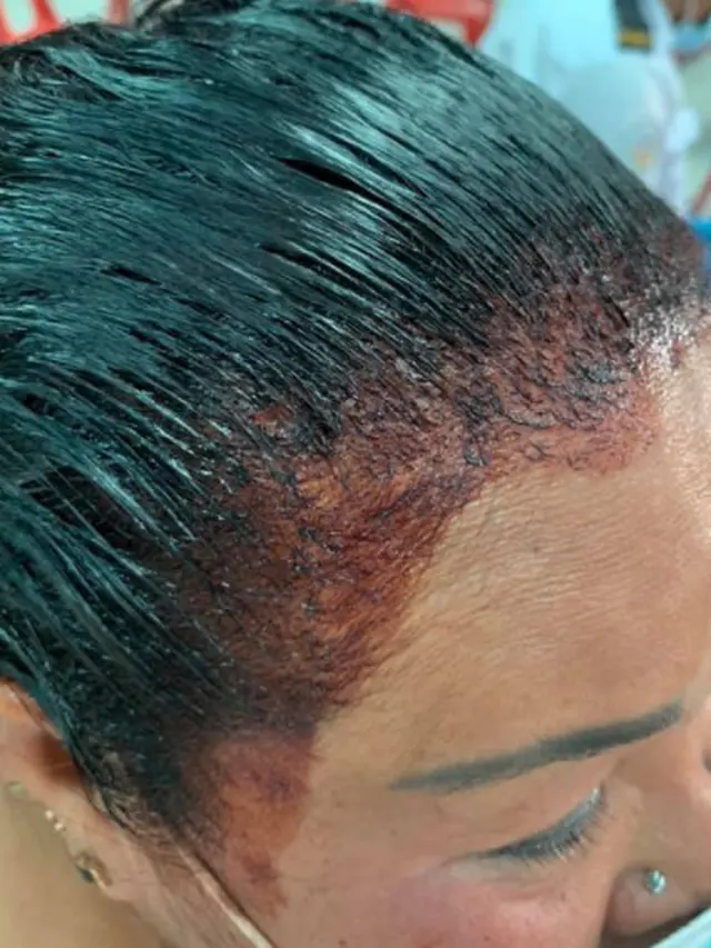 Bikin Ngakak, Ibu Ini Buru-Buru ke Tempat Vaksinasi Covid dengan Rambut Baru Dicat Separuh