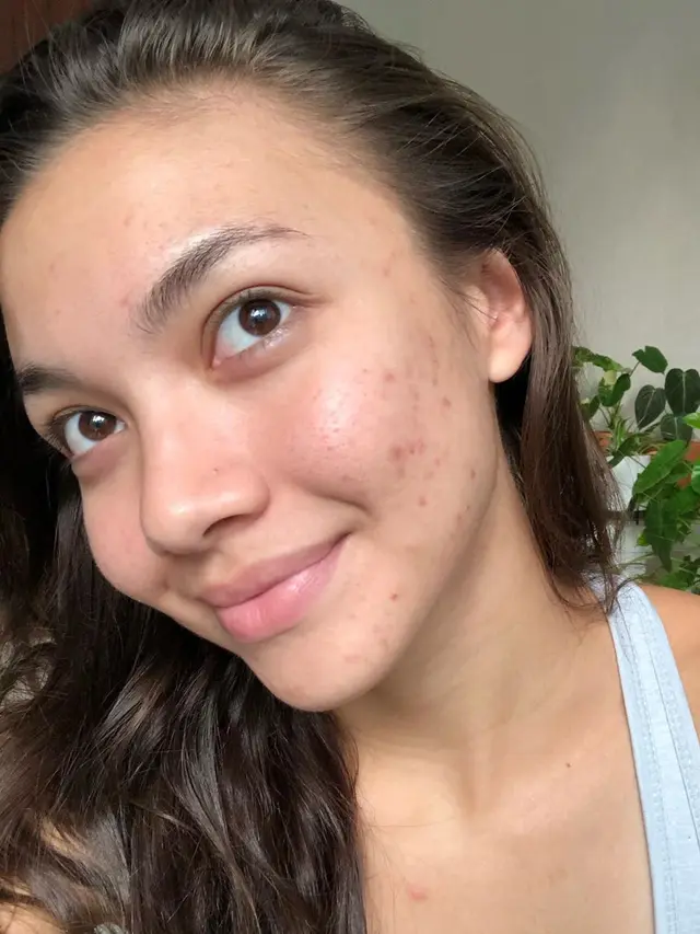 6 Seleb Indonesia Ini Tak Segan Unggah Foto Tanpa Makeup, Banjir Pujian