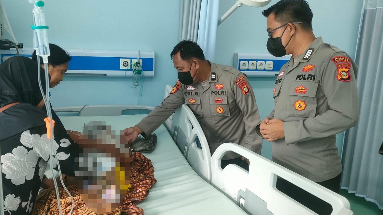 Kronologi Ibu dan Balita di Musi Rawas Sumsel Alami Luka Bakar Parah usai Disambar Petir saat Tidur di Rumah
