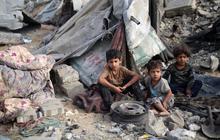 FOTO: Sedihnya Anak-Anak Palestina di Jalur Gaza Dihantui Penyakit Mematikan Ini