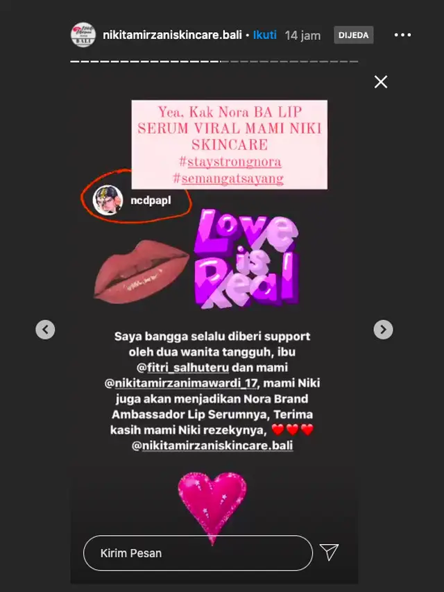 Nora Alexandra Jadi Brand Ambassador Produk Kecantikan Nikita Mirzani