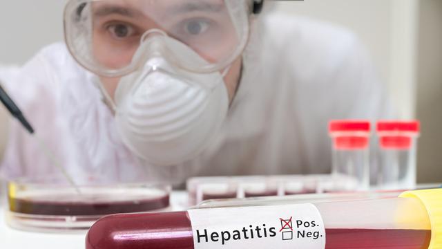 Ilustrasi penyakit hepatitis