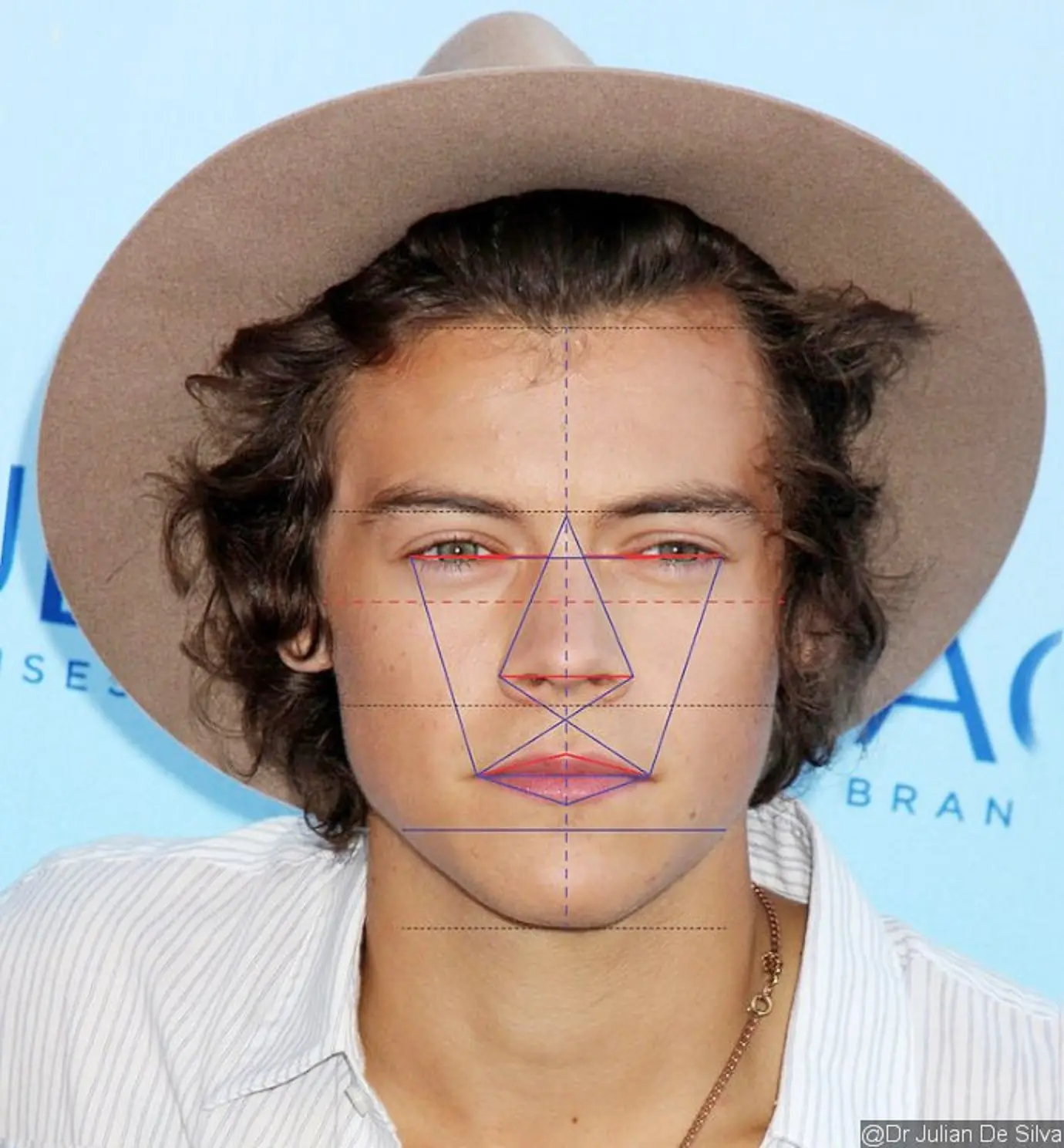 Simetri wajah Harry Styles (Sumber: Dr Julian De Silva/ Ace Showbiz)