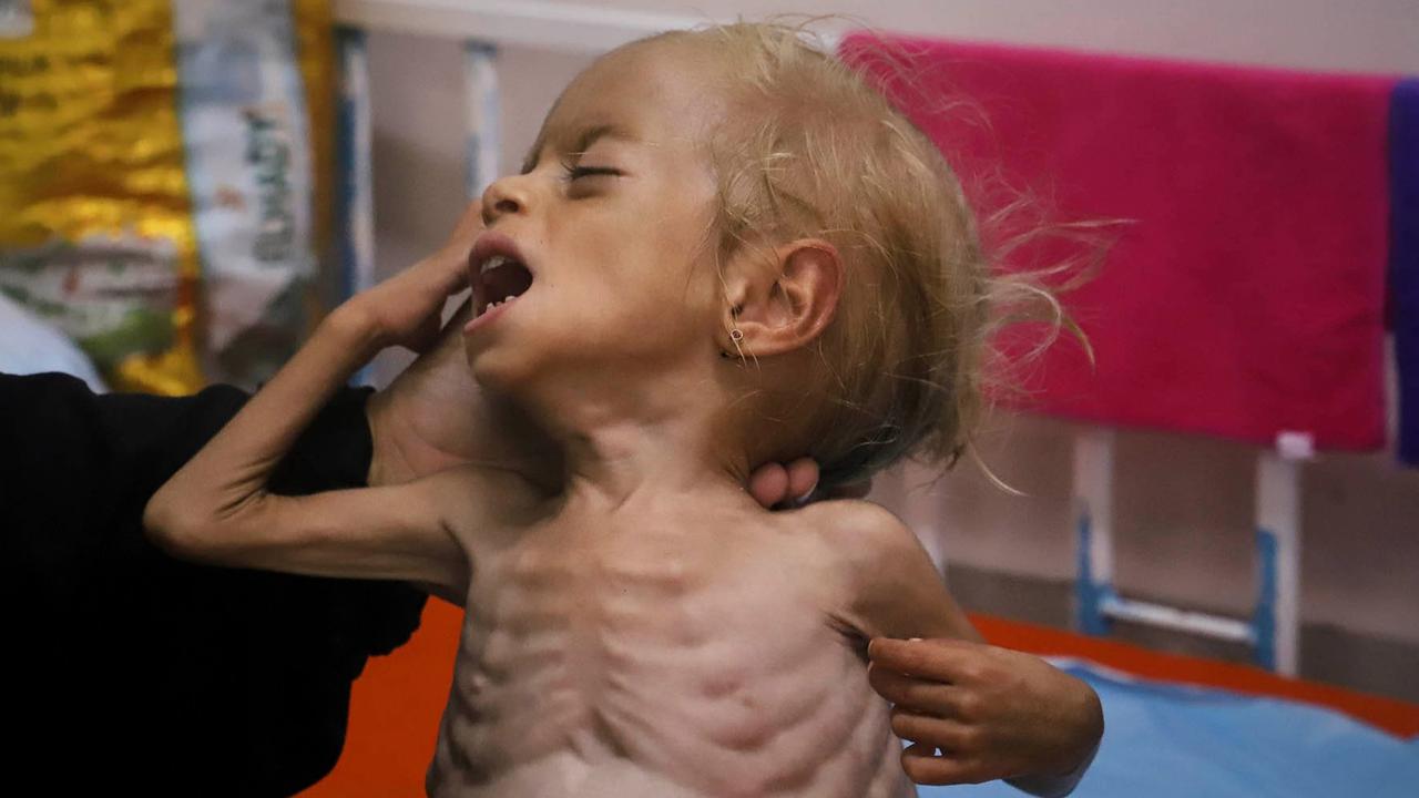 Laporan Investigasi: Israel Bayar Google USD45 Juta untuk Tutupi Kelaparan di Gaza