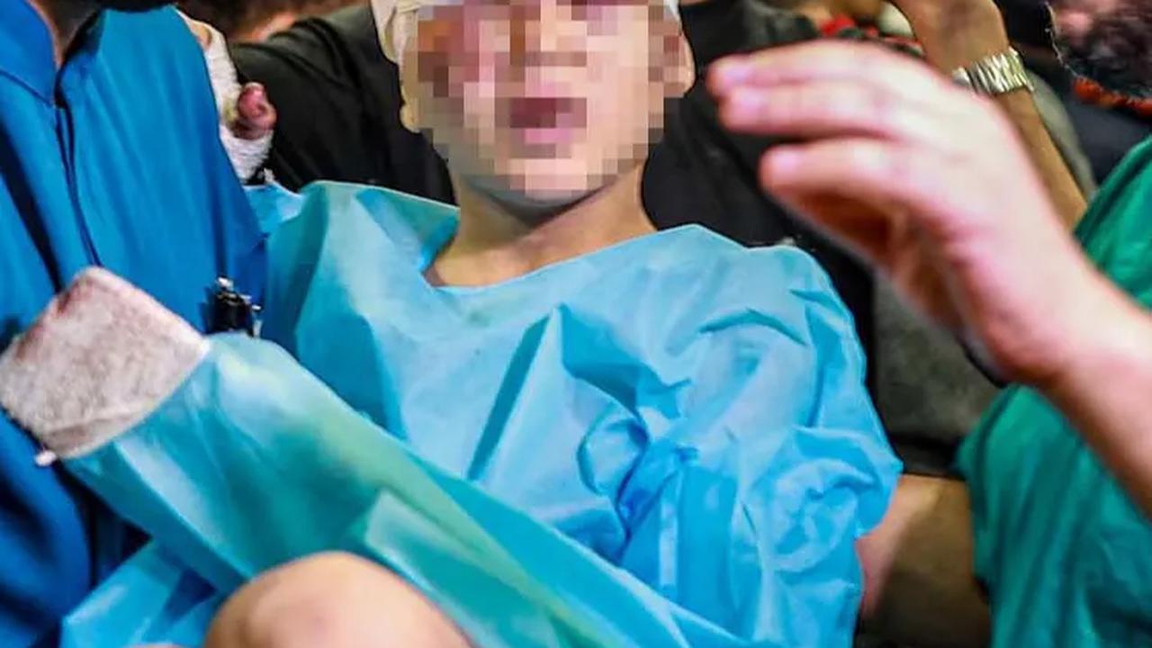 Pertama Kali Sejak 34 Tahun, PBB Tekan Tombol Panik karena Situasi Gaza Makin Memburuk Akibat Serangan Israel