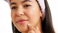 Bye Jerawat Meradang, Ini Acne Patch Terbaik yang Lagi Banyak Dicari