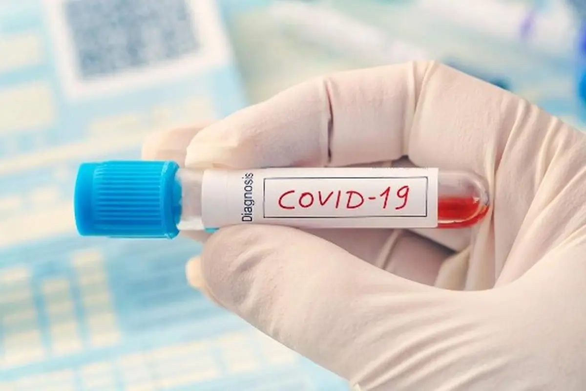 Dorce Gamalama Meninggal Akibat Covid-19, Alasan Pasien Komorbid Sulit Melawan Infeksi Virus