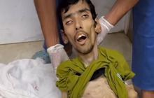 VIDEO Mirip Tengkorak Tinggal Kulit Pembalut Tulang, Pria Gaza Meninggal karena Kelaparan Akut