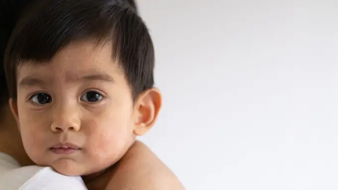 Waspada Gejala Alergi Mengganggu Proses Belajar Si Kecil, Yuk Dukung dengan Asupan Nutrisi yang Tepat!