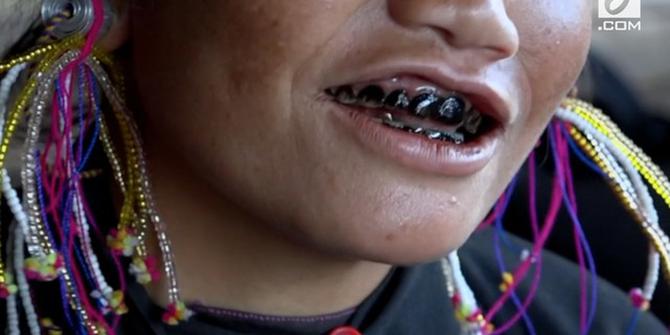 VIDEO: Wanita Desa Ini Hitamkan Gigi agar Tampil Cantik