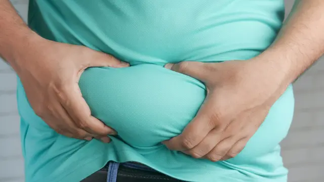 Obesity
