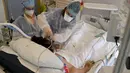 Tenaga medis merawat pasien yang terinfeksi Covid-19 di unit perawatan intensif rumah sakit Timone, di Marseille, Prancis, Rabu (5/1/2022). Prancis mencatat rekor kasus baru Covid-19 dalam sehari pada Rabu waktu setempat dengan 335.000 tambahan kasus baru infeksi. (Nicolas TUCAT / AFP)