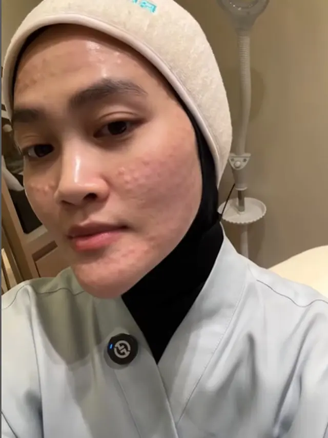 6 Potret Perubahan Wajah Henny Rahman Setelah Perawatan, Makin Cerah dan Mulus