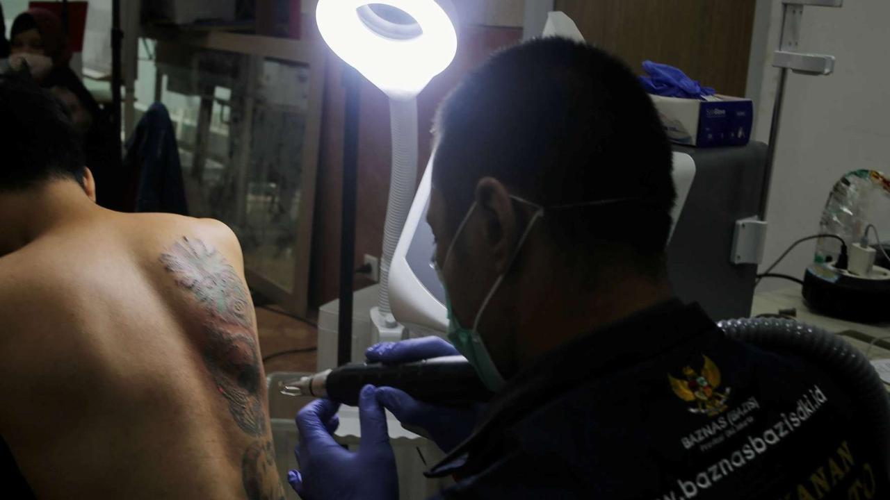 FOTO: BAZNAS DKI Buka Layanan Hapus Tato Gratis Selama Ramadan, Ini Lokasi dan Cara Daftarnya!