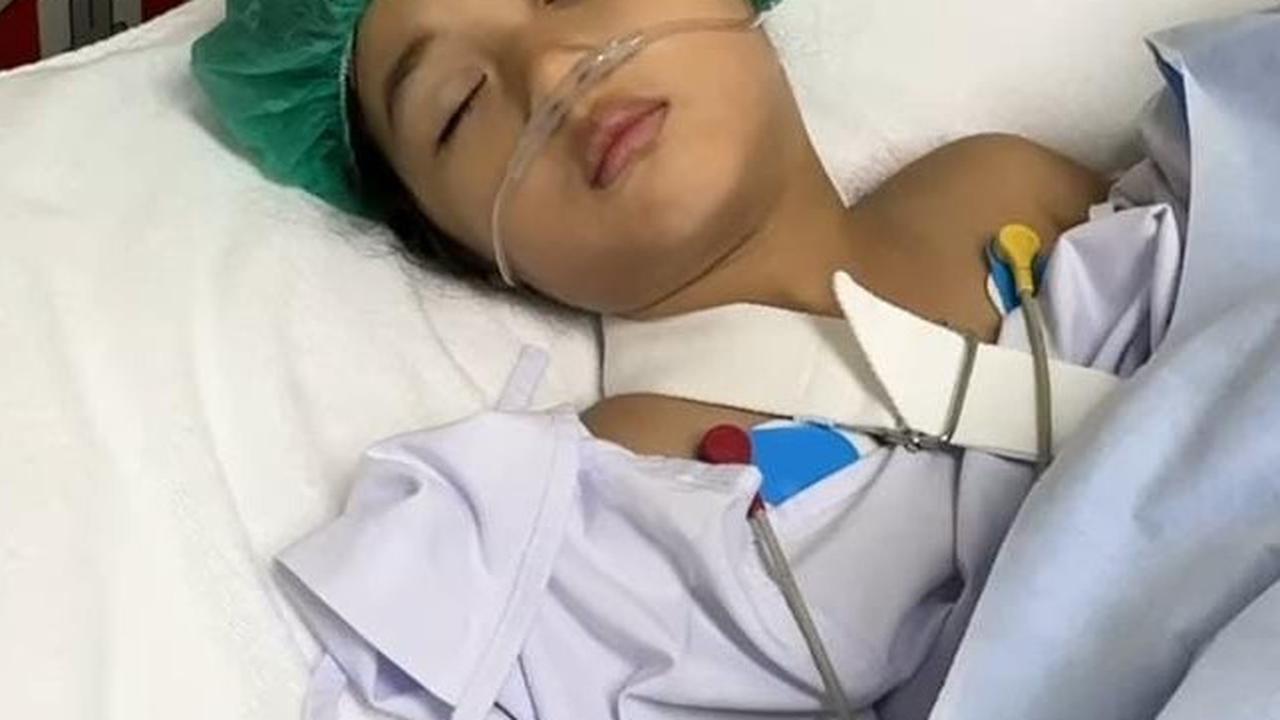 Kondisi Putri Cantik Kevin Lilliana Usai Operasi Karena Patah Tulang Siku Usai Jatuh dari Kursi di Rumah