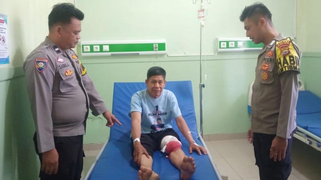 Warga Rejang Lebong Nyaris Tewas Diserang Beruang Madu di Kebun Kopi