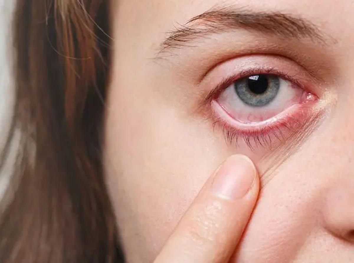 Tanda-Tanda Retinoblastoma pada Anak Sejak Dini