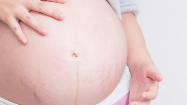 Cara Mudah Cegah Stretch Mark Saat Hamil
