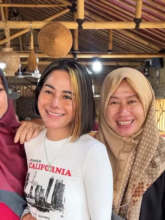 Potret Hasil Oplas Hidung Farida Nurhan