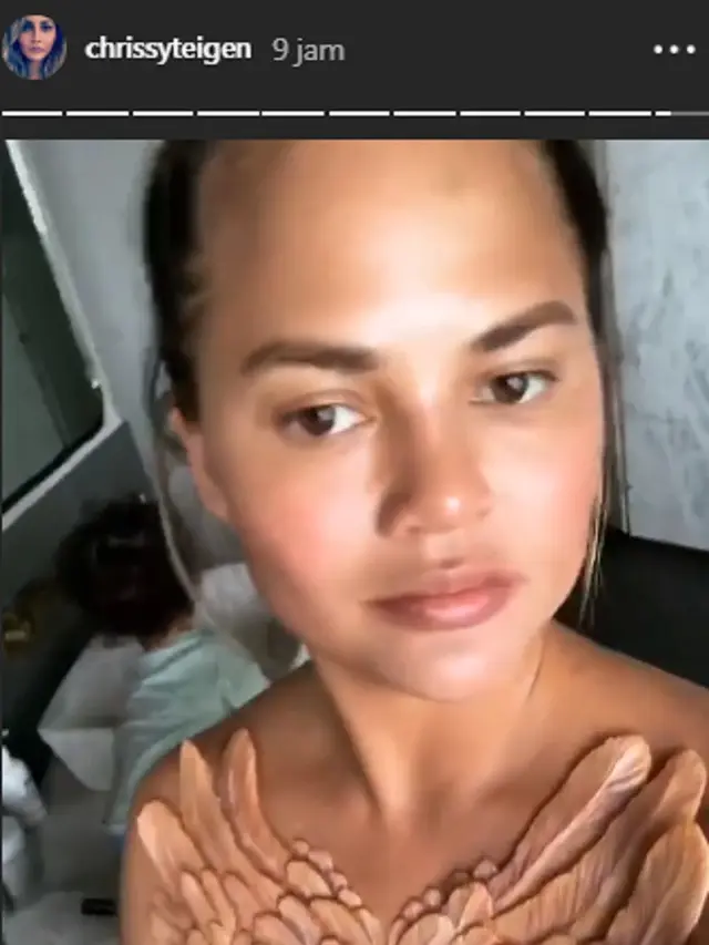 [Bintang] Chrissy Teigen