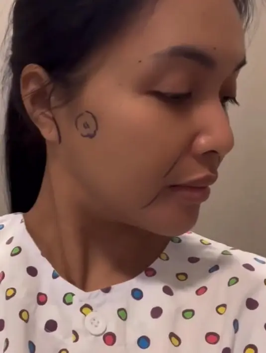 <p>Demi penampilannya, Denada memberanikan untuk menjalani operasi. Padahal, dia mengaku takut dengan alat-alat operasi, seperti jarum suntik. Menangis hingga zikir dilakukan sebelum operasi. [Instagram/denadaindonesia]</p>