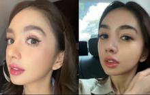 Angel Karamoy Pamer Hasil Operasi Plastiknya Setelah Tiga Bulan, Senyumnya Lebih Alami Meskipun Masih Sulit Tertawa
