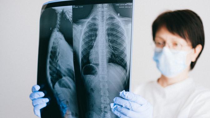 Paul merupakan orang terakhir yang bertahan hidup dengan paru-paru besi usai terinfeksi polio saat usianya baru 6 tahun. | pexels.com/@shvetsa