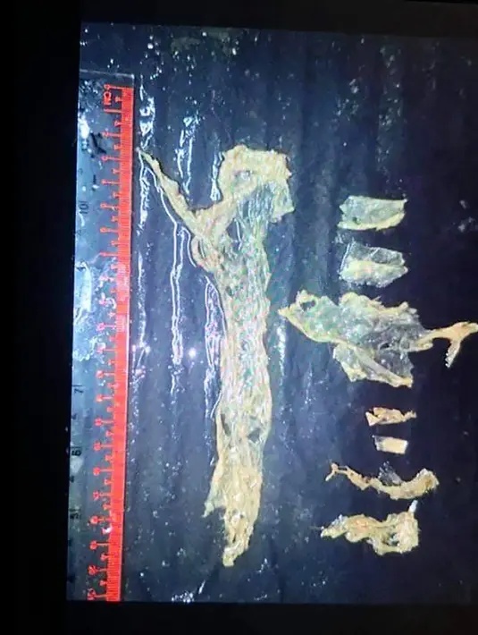 Gambar pada 17 Agustus 2019 memperlihatkan potongan plastik yang ditemukan di saluran usus seekor bayi dugong bernama Mariam di Taman Laut Provinsi Trang, Thailand. Saat otopsi, beberapa potong plastik termasuk yang berukuran 20cm ditemukan di dalam perut bayi dugong tersebut. (HO/DNP/AFP)