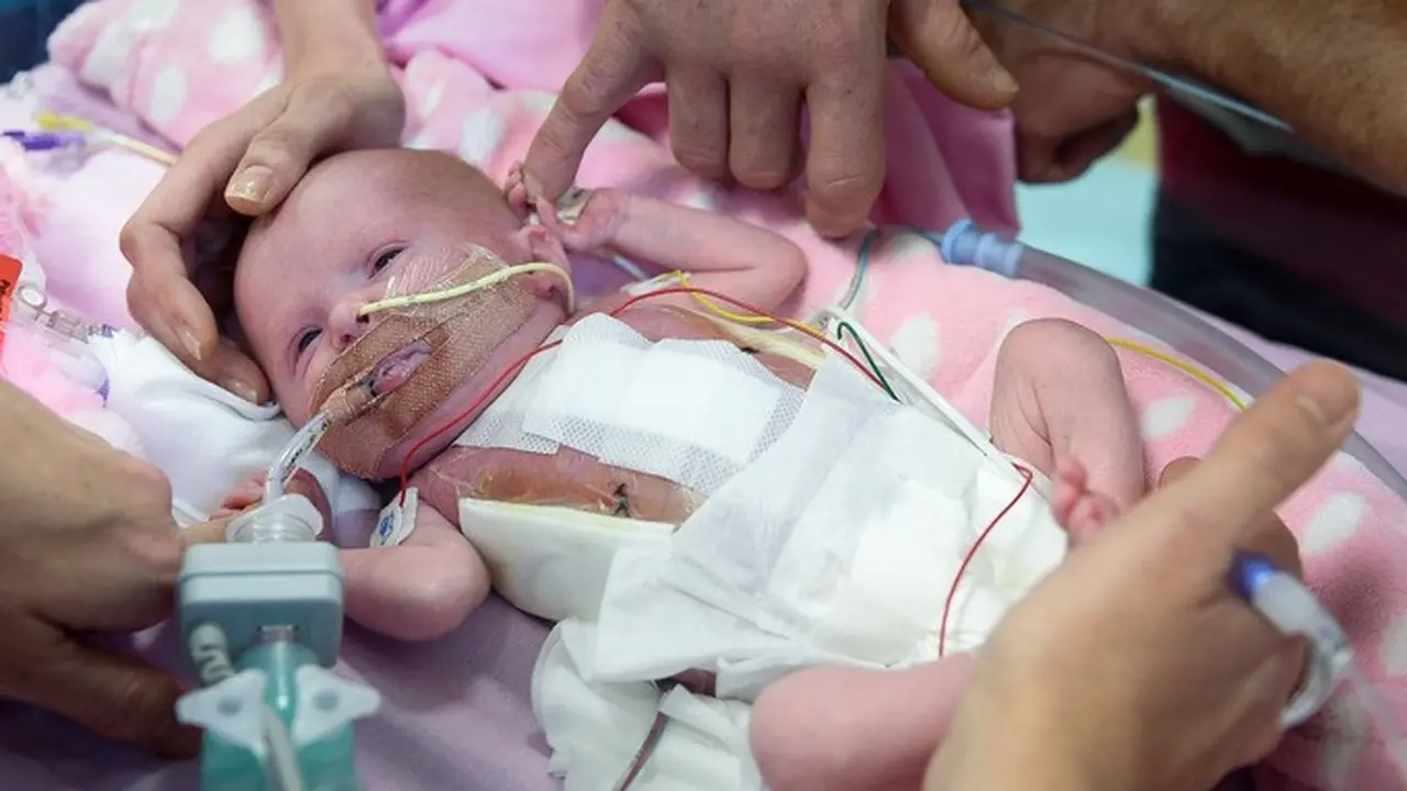 Organ Jantung Keluar Dari Tubuh, Bayi ini Tetap Selamat