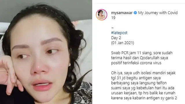 Mawar AFI 1 Terpapar Covid-19, Alami Gejala Batuk Kering dan Sesak
