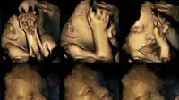 Penelitian kecil dilakukan di Inggris mengungkap foto janin dari ibu yang merokok menggunakan USG 4 Dimensi. Hasilnya, cukup miris.