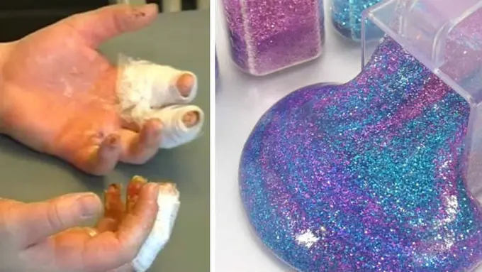 Slime dan dampaknya/Facebook dan Pinterest