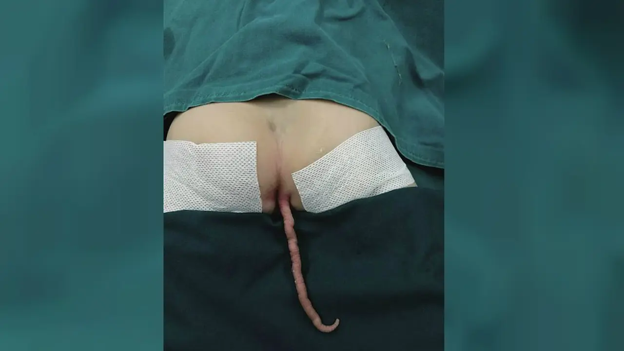Inikah Bocah Titisan Kera?