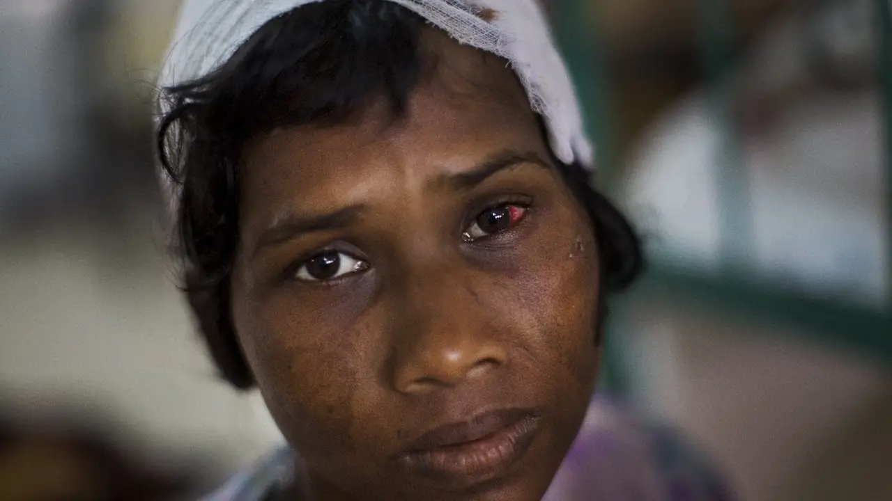Dildar Begum, perempuan Rohingya mengaku menjadi korban penusukan akibat serangan militer Myanmar di Rakhine, tengah mendapat perawatan di rumah sakit di Cox Bazar, Bangladesh. Kepada AP, ia menuturkan, suaminya tewas akibat serangan tersebut (AP)