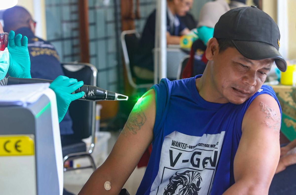 FOTO: Layanan Hapus Tato Gratis Sambut Ramadhan di Jakarta
