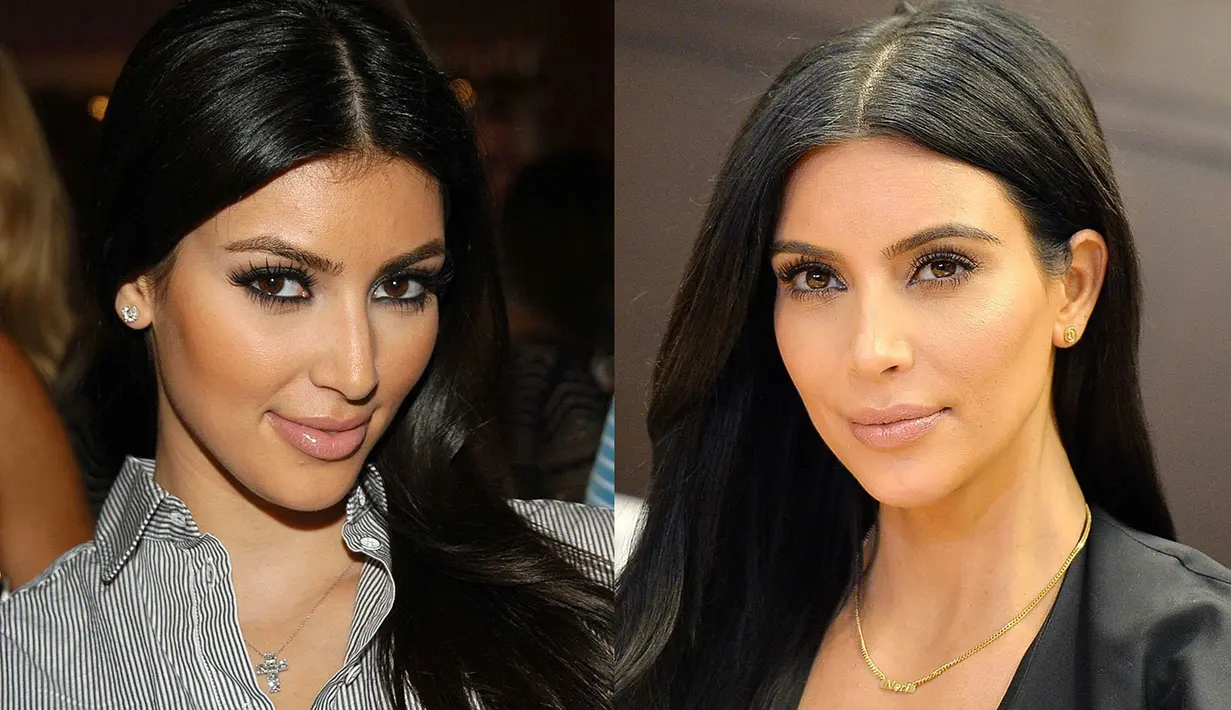 Meski bibir Kim Kardashian sudah tebal sedari dulu. Namun apa kamu melihat perbedaannya? (The Sun)