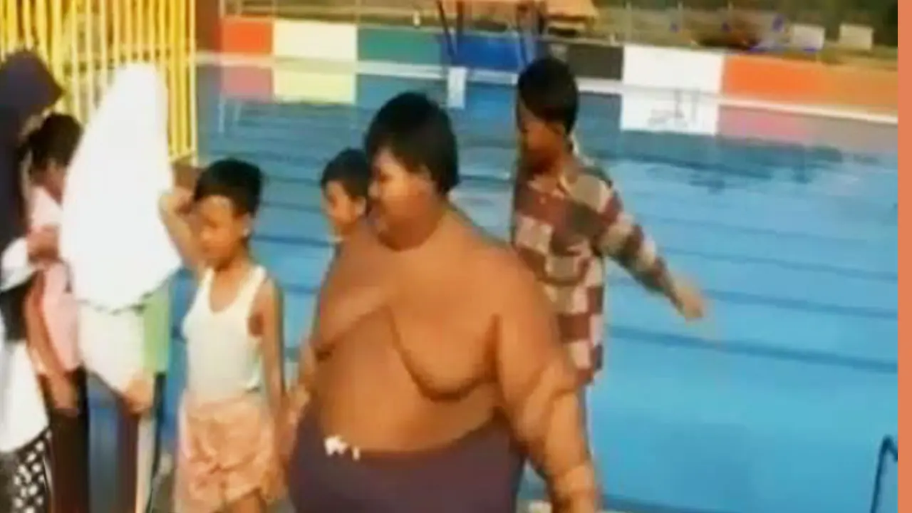 Bocah Obesitas