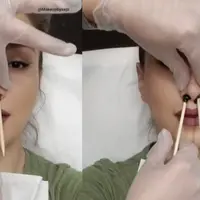 Ini alasannya kenapa cabut bulu hidung ternyata berbahaya untuk kesehatanmu. | via: seventeen.com