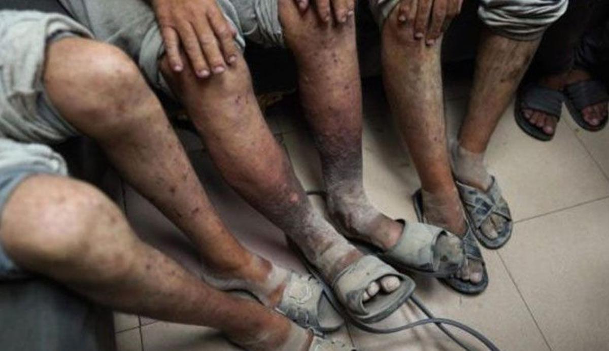 Temuan Lembaga Pengawas: Israel Sengaja Sebar Wabah Penyakit di Kalangan Tahanan Palestina
