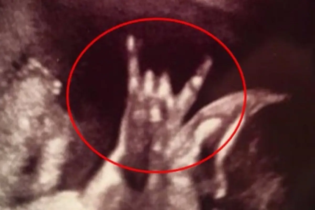Fenomenal, Foto USG Janin Bergaya Rock Bikin Netizen Melongo