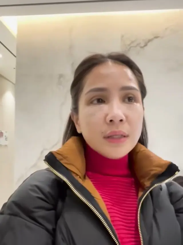 Nagita Slavina Perawatan
