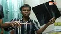 Seorang pasien yang diduga menjadi korban malpraktik mengamuk di RS Sundari, Medan, Sumut, tempat ia dirawat. Sang pasien menuding pengobatan yang dilakukan tim medis terhadap dirinya justru mengakibatkan luka di tangannya terus membusuk. 
