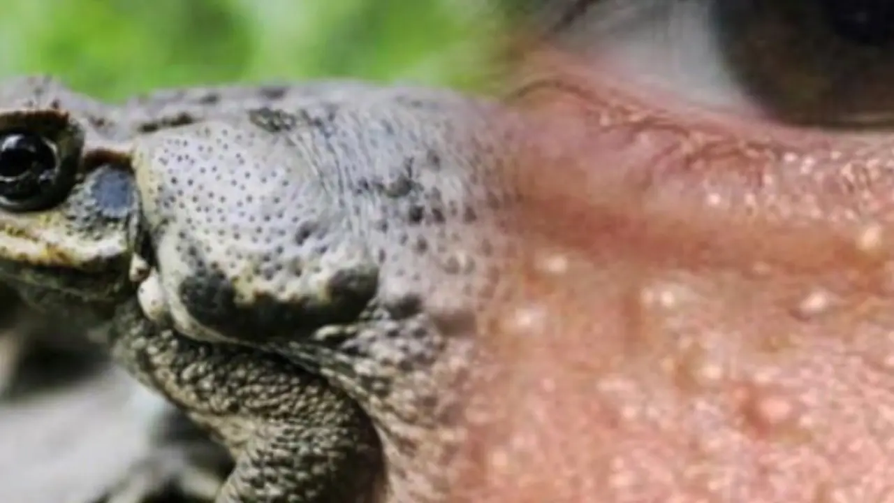 Diduga Disantet, Tubuh Wanita Ini Bruntusan Bak Kulit Katak Usai Dua Kali Tolak Lamaran