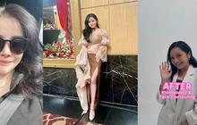 Mengaku Awalnya Hanya Ikut-ikutan Teman, Mawar AFI Ungkap Alasan Kerap Lakukan Operasi Plastik