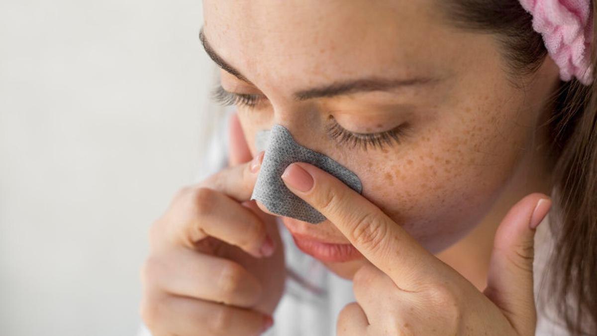 Penyebab Komedo Membandel dan Tips Membersihkannya dengan Aman