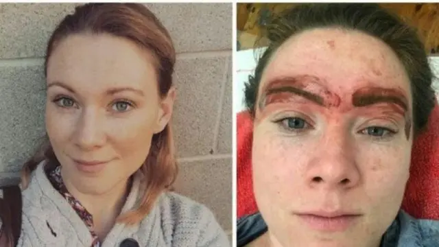 Sulam Alis dengan Promo Murah? Hati-hati Akan Alami Hal Ini